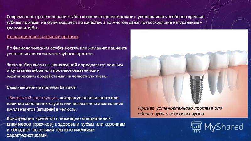 Анализ доступных материалов для зубных протезов